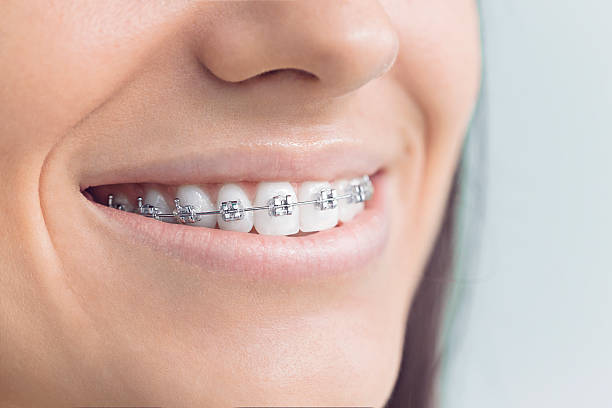 Best Traditional Braces  in Jonesville, NC